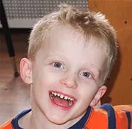 Child smiling with mouth open