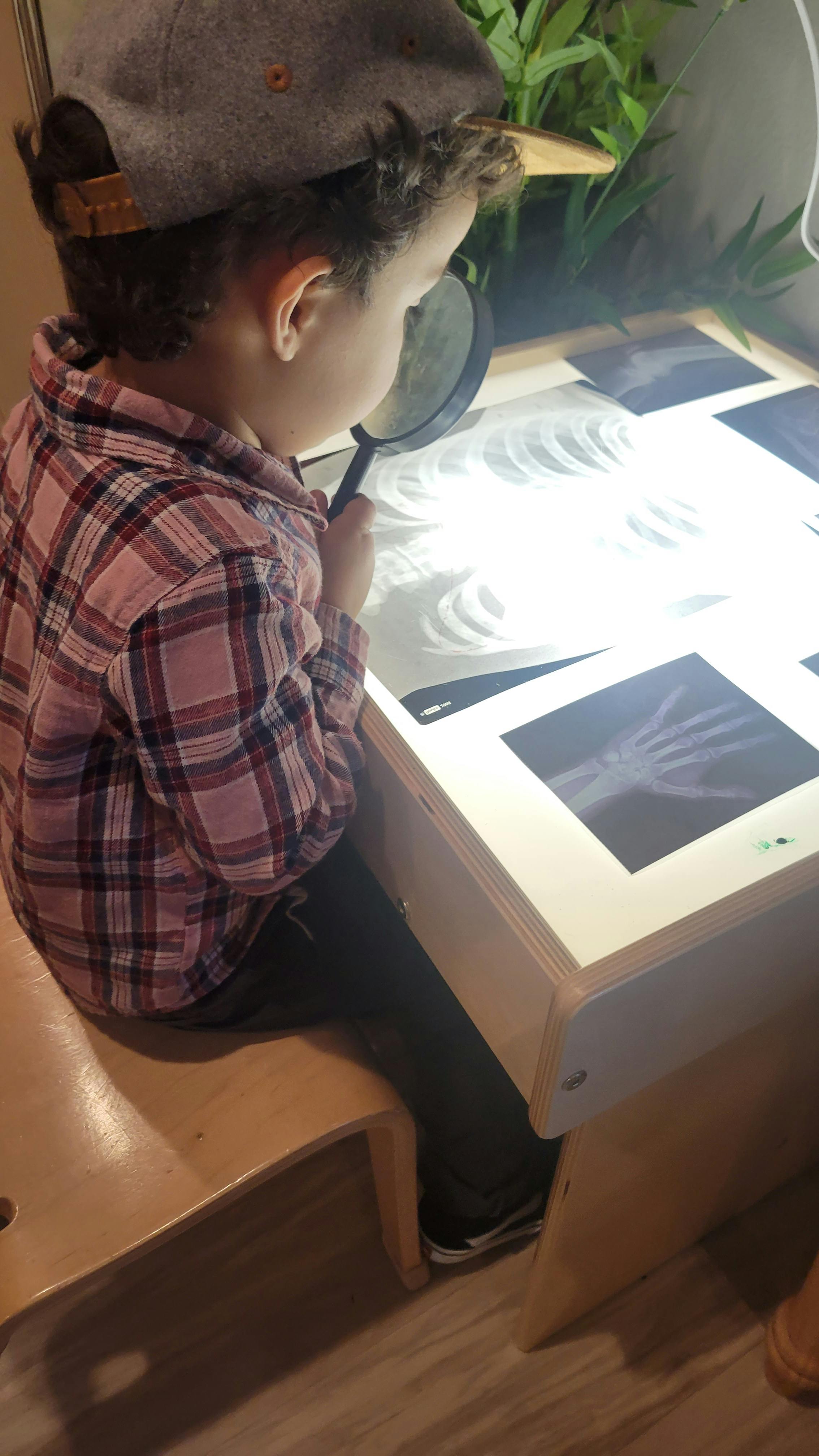 Child looking through a magnifying glass at a light table with x-rays