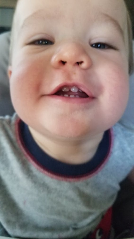 How Many Teeth Should You Have By What Age Winnie