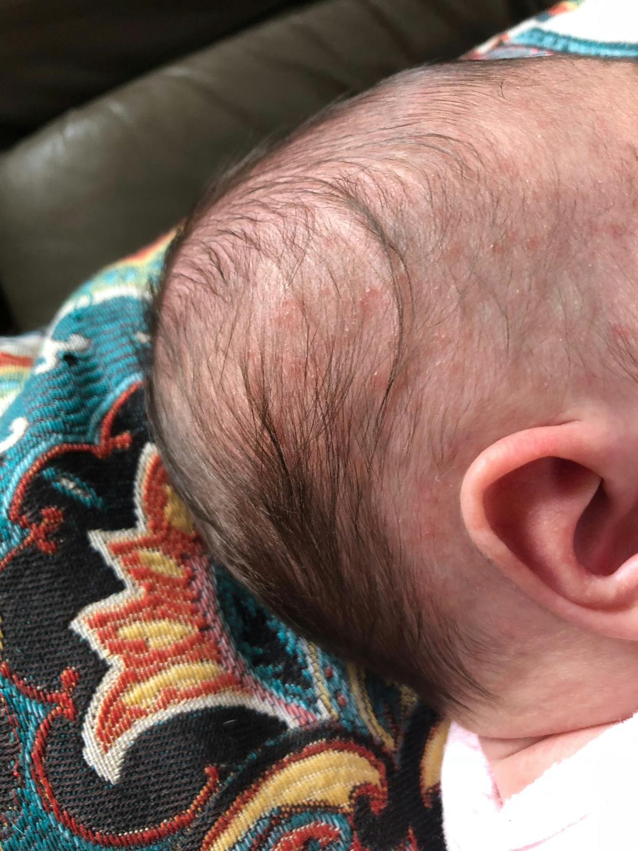 Bumps On Head Winnie