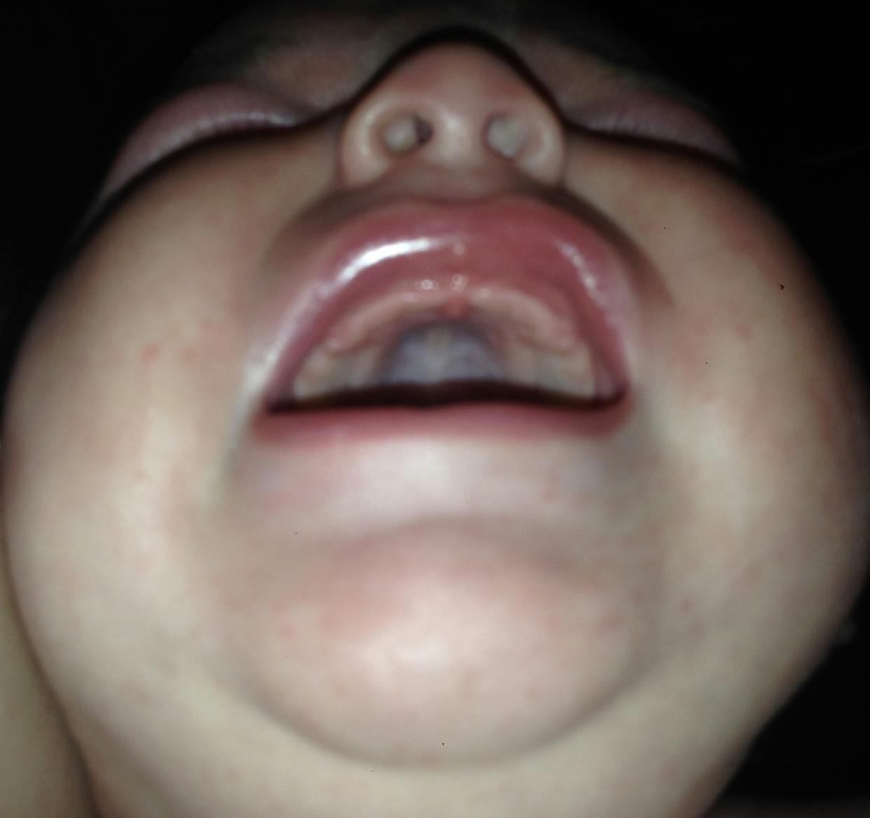 4 month old teething